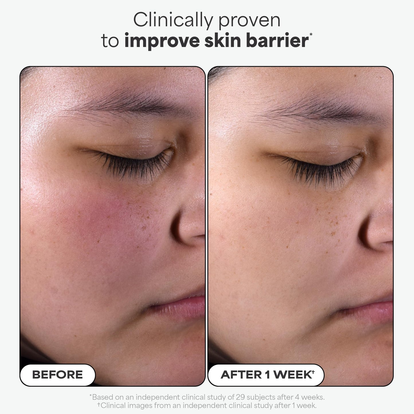 Paula's Choice Skin Perfecting 2% BHA Exfoliante Liquido - Peeling Facial Combate los Puntos Negros, Poros Dilatados, Espinillas y Acne - con Ácido Salicílico - Piel Mixta a Grasa - 118 ml