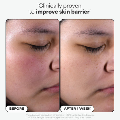 Paula's Choice Skin Perfecting 2% BHA Exfoliante Liquido - Peeling Facial Combate los Puntos Negros, Poros Dilatados, Espinillas y Acne - con Ácido Salicílico - Piel Mixta a Grasa - 118 ml